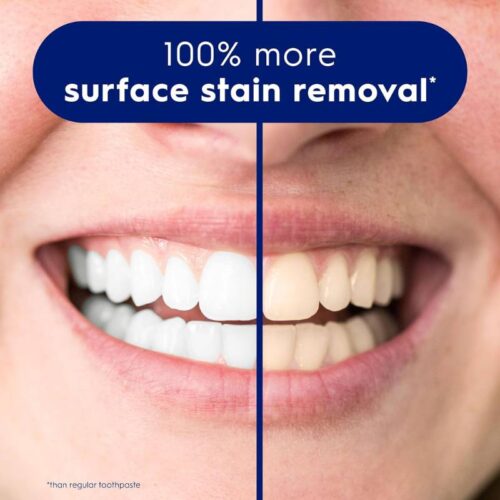 Kem đánh răng Crest 3D White 1